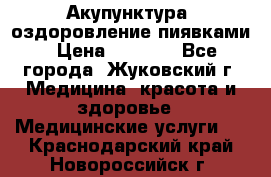 Акупунктура, оздоровление пиявками › Цена ­ 3 000 - Все города, Жуковский г. Медицина, красота и здоровье » Медицинские услуги   . Краснодарский край,Новороссийск г.